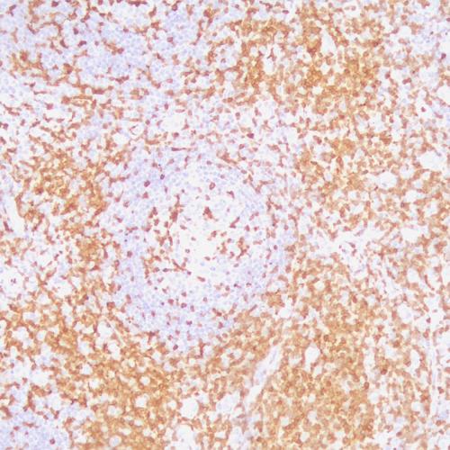 ZAP-70標(biāo)記人扁桃體